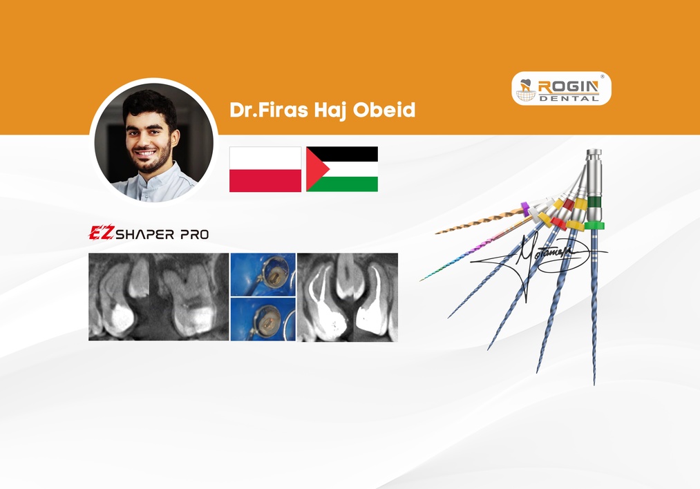 Shaper Class Roro 利用 EZ Shaper Pro 系统掌握复杂的解剖结构 - RoginDental