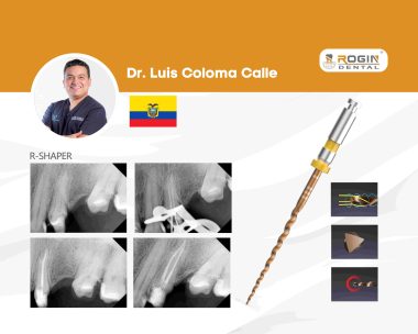 Abordaje Endodóntico de Calcified Canal Cases con Curvaturas Severas_backgroup
