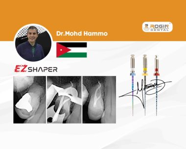 Advanced Endodontic Case: Successful RCT on Maxillary First Premolar with Severe Apical Curvature by Dr. Mohd Hammo (Jordan)