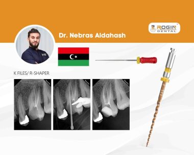 Advanced Endodontic Retreatment: Separated Instrument Retrieval in Tooth 26 with Limited Mouth_cover