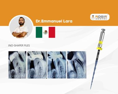 Advanced Endodontic Retreatment of a Lower First Molar_cover