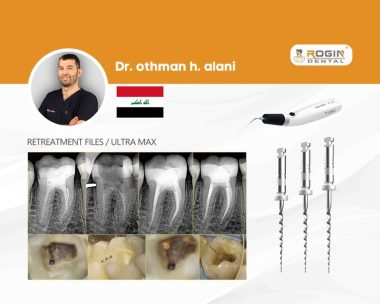 Advanced Endodontic Retreatment_1