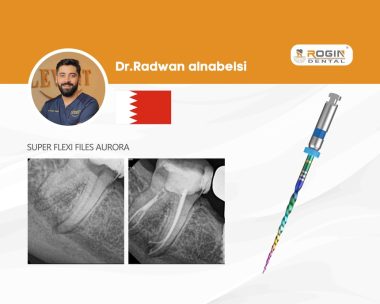 Advanced Root Canal Treatment of a Four-Rooted Mandibular Second Molar_cover