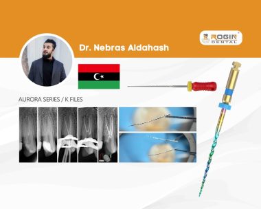 Complex Endodontic Case_cover