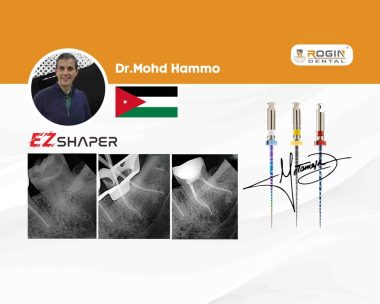 Conservative Endodontic Treatment of a Mandibular Third Molar with Double-Curved Mesial Canals_cover