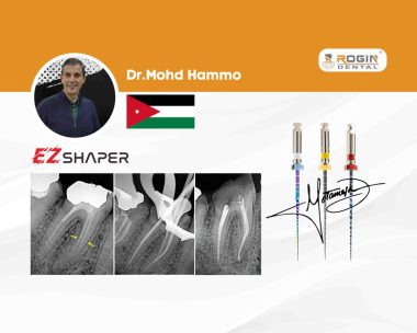 Conservative Management of Narrow, Curved Canals in a Mandibular First Molar_cover