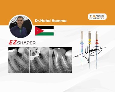 Conservative Root Canal Treatment of a Lower First Molar with Narrow, Moderately Curved Canals_cover