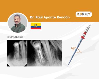 Desafío+anatómico+en+premolar+inferior+con+conﬁguración+tipo+VIII+12