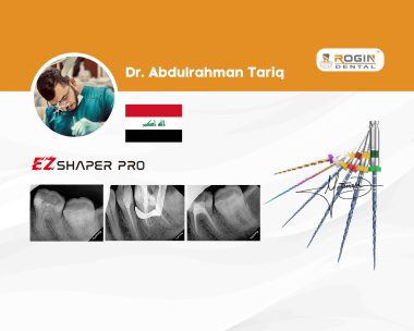 Endodontic Management of Tooth #46 with Acute Irreversible Pulpitis and Vertucci Type II Mesial Canals_cover_1