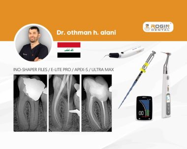 Extreme Length Root Canal Treatment_cover