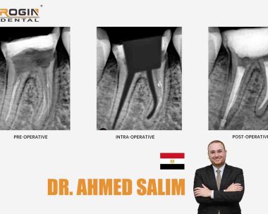 Lateral Root Perforation in Mandibular First Molar_cover