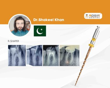 Managing Calcified Canals in a Curved Mandibular First Molar_cover