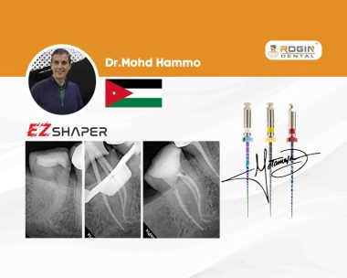 Managing-Double-Curvature-in-a-Mandibular-Third-Molar-Conservative-Shaping-of-Narrow-Canals-with-Thin-Roots_cover