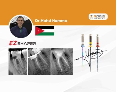 Managing Narrow Canals with Severe Apical Curvature in a Mandibular First Molar_cover