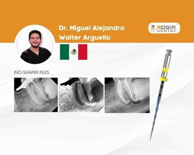 Managing Severe Root Canal Curvatures with Ino Shaper_cover