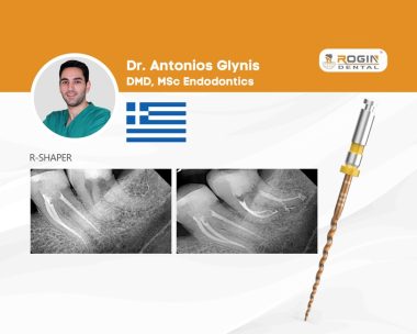 Managing a Severely Curved LL8 with the Rogin R-Shaper System_cover