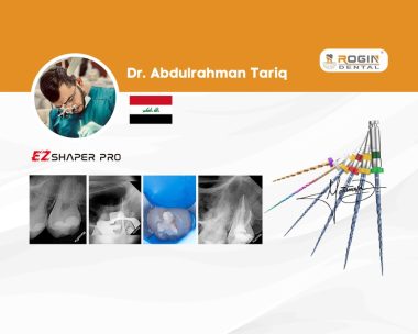 Overcoming Access Challenges in Upper Third Molar Root Canal Treatment_cover