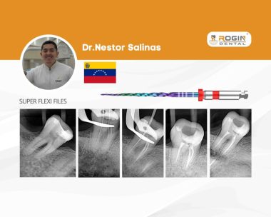 Restauración Desadaptada con Sobrecarga Mecánica Severa, Necrosis Pulpar y Periodontitis Apical Sintomática_cover