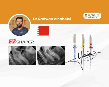 Root Canal Treatment of a Lower Second Molar with Severely Curved Canals_cover