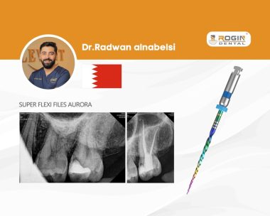 Root Canal Treatment of a Maxillary Second Molar_cover