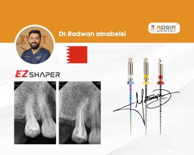 Root Canal Treatment of an Upper Premolar with S-Shaped Canal_cover