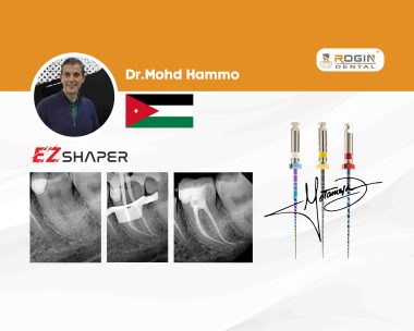 Smooth Shaping and Anatomy Preservation in Narrow Curved Canals with EZ-Shaper® Files_cover