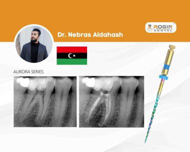 Successful Endodontic Management of a Complex Mandibular First Molar with Symptomatic Apical Abscess_cover