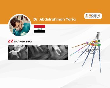 Successful Endodontic Retreatment of a Mandibular Molar with Iatrogenic Apical Perforation_cover