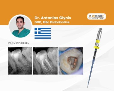 Successful Endodontic Treatment_cover
