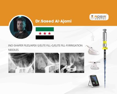Successful Management of Separated Instrument in Root Canal_cover