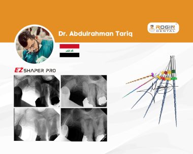 Successful Management of a Completely Calcified Upper Premolar with Periapical Lesion_cover