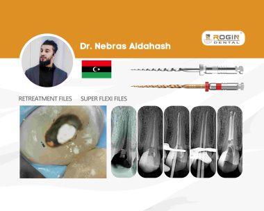 Successful Non-Surgical Retreatment_4