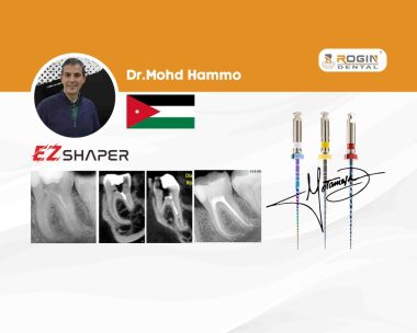 Successful Root Canal Treatment of a Challenging Mandibular First Molar with Severe Curvatures Using EZ-Shaper_cover