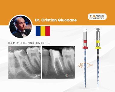 Successful Root Canal Treatment on Tooth #36_cover