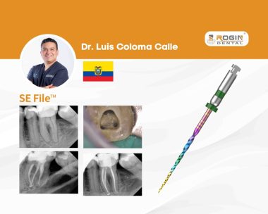 Tratamiento Endodóntico de Periodontitis Apical Sintomática en Diente 36 con Anatomía Radicular Compleja_cover