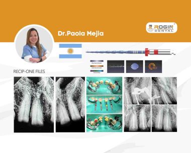 Tratamiento Endodóntico en Sector Anterior Superior con Desgaste Severo por Bruxismo Crónico_cover