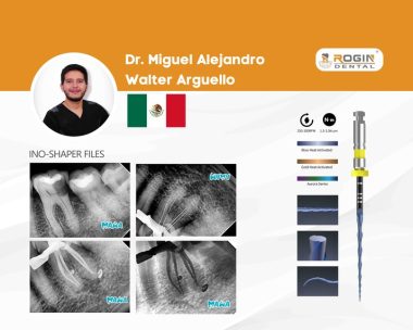 Tratamiento de Conducto en Diente_cover