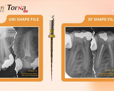 rogindental-rotary-file-product-case